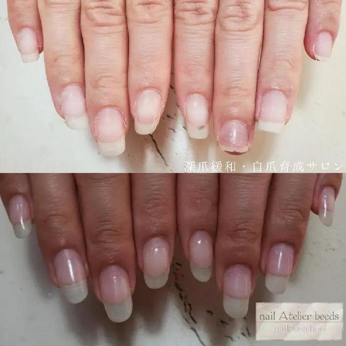 ジェルの持ちが悪いお客様もこの通り育成次第でどうにでもかわれちゃう Nail Atelier Beeds所属 前村 瑛梨奈のネイル デザイン ミニモ
