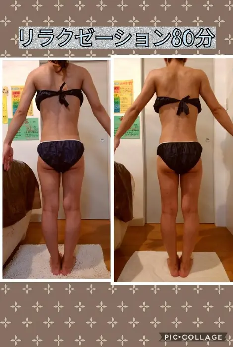 リラクゼーションメニューのビフォー アフターです 全身スッキリ痩身効果も Premier Beaute所属 西野 妙加のエステ リラクカタログ ミニモ