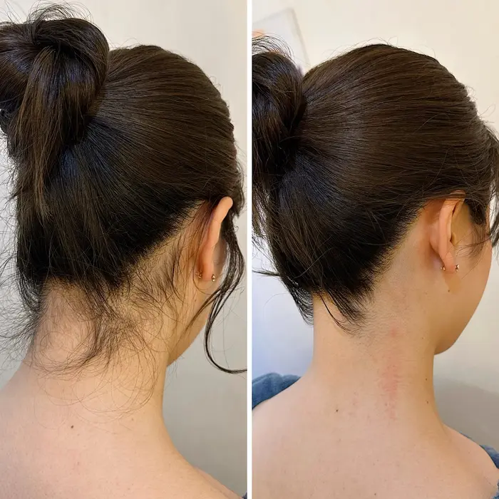 うなじ脱毛

どんどん温かくなりアップヘアをする機会が
増えると思いま?...