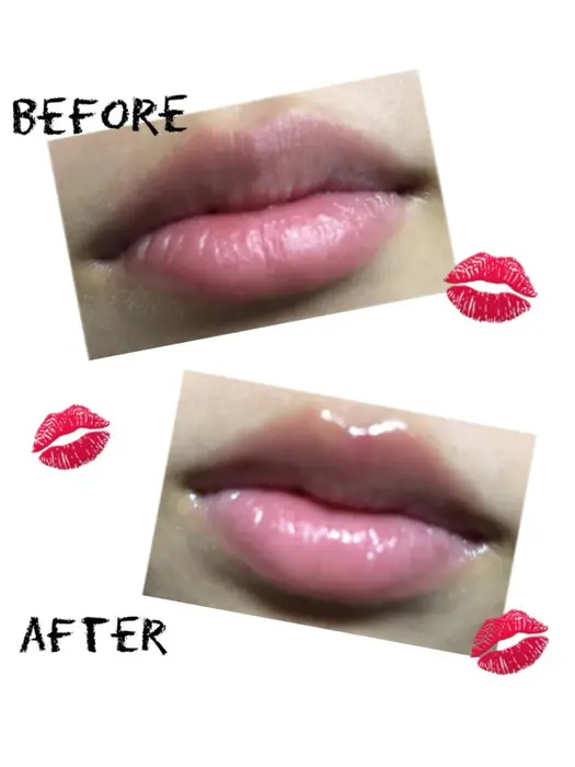 唇のかさつきなどにぷるぷる リップエステ 唇ケア をしてみませんか リップの縦ジワが気になる Faceline Fleur所属 杉浦 芳子のエステ リラクカタログ ミニモ