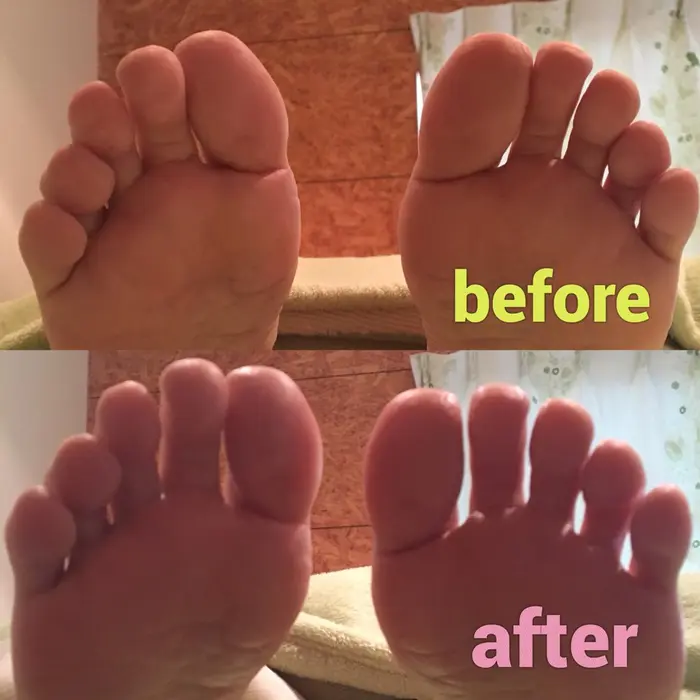 足底ケア 爪ケア ひざ下リフレ カウンセリング込み 1分 どれかなんて 選べない トータ Footcare Salon Nicolulu所属 足トラブル専門店 ニコルルのネイルデザイン ミニモ