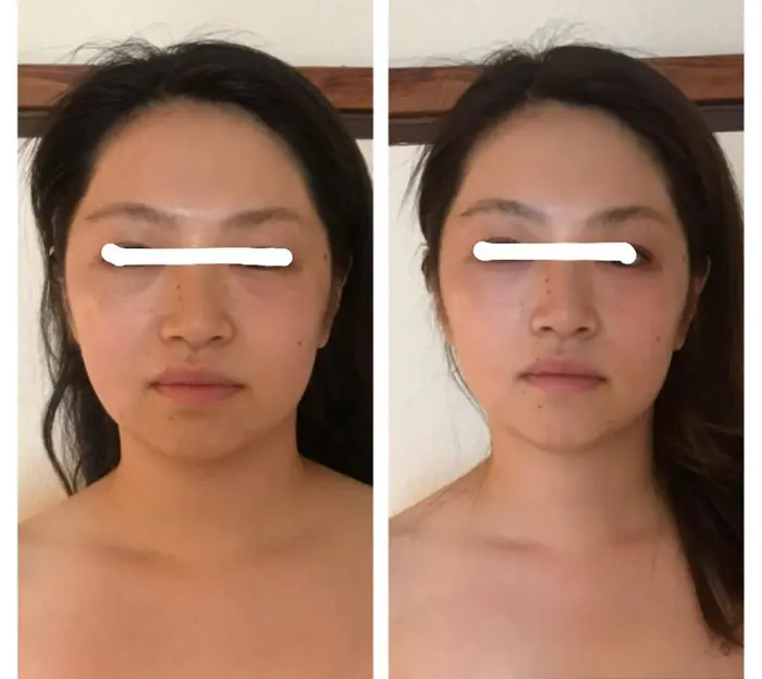 お顔の浮腫が取れてスッキリ 最後はコルギで綺麗に中に入れてあげましょう シェイプラボ所属 Shapelabo 店長 高橋のエステ リラクカタログ ミニモ