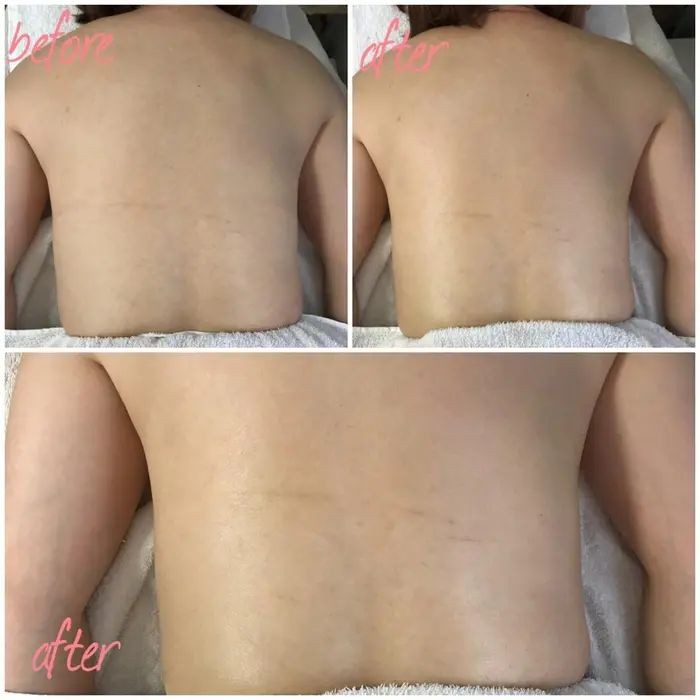 1回の施術です 背中全体中心に脇腹から腰のラインを特にマッサージさせて頂きました Salon Plaisir プレズィール 所属 酒井 瑠未のエステ リラクカタログ ミニモ