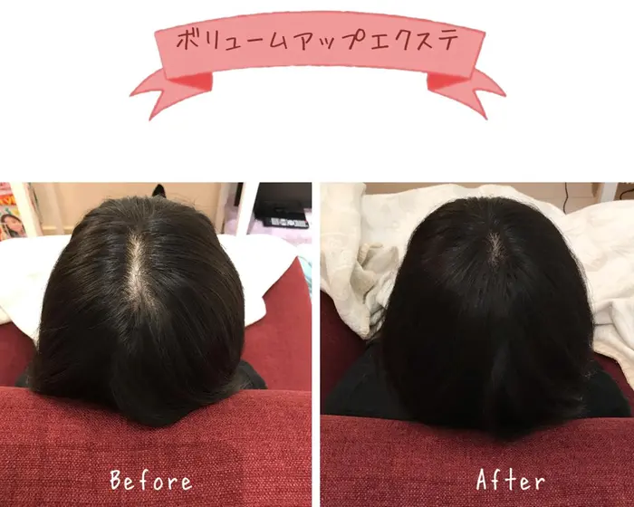 つむじ トップに1000本 ボリュームアップエクステ専門店fu Wa Ri所属 髪のボリュームアップ Fu Wa Riのヘアカタログ ミニモ