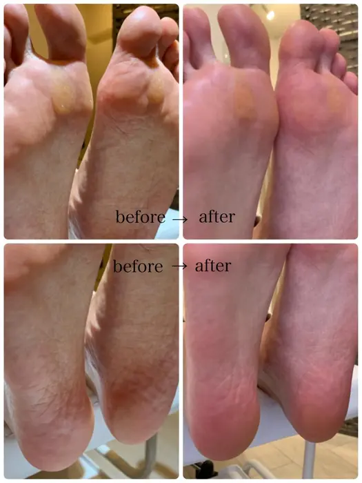 一回でもこんなにツルツル ふわふわな足裏に ベルトリージェイ福島店所属 ベルトリージェイ 中田奈緒のネイルデザイン ミニモ