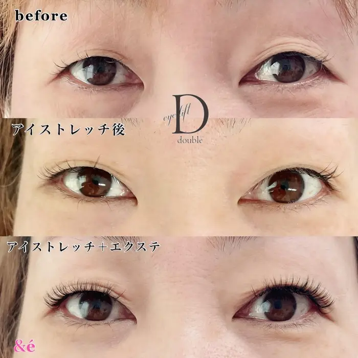 アイストレッチ エクステ 1回15分のアイストレッチでここまで変化が出ました 効果には個人差があ E アンドイー 所属 E アンドイーのマツエク デザイン ミニモ