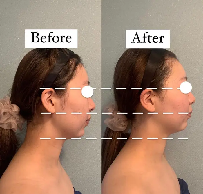 キャビテーションフェイシャル キャビテーション リンパケア 洗顔 毛穴引き締め美白パック 贅沢保湿 Miin所属 天王寺エステサロン ミーンのエステ リラクカタログ ミニモ