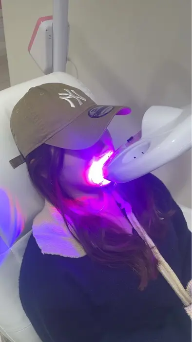 ︎学生限定クーポン◎大人気のセルフホワイトニングが格安価格でお試し?...