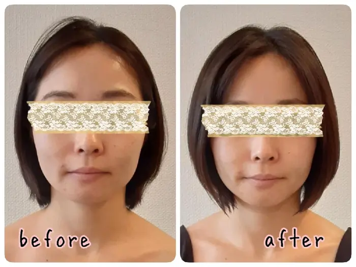 輪郭スッキリ 口元もキュッとあがりました お顔の左右差がとれて美人度アップ 女性専門 Luna Time 整体院所属 Luna Time 整体院のエステ リラクカタログ ミニモ