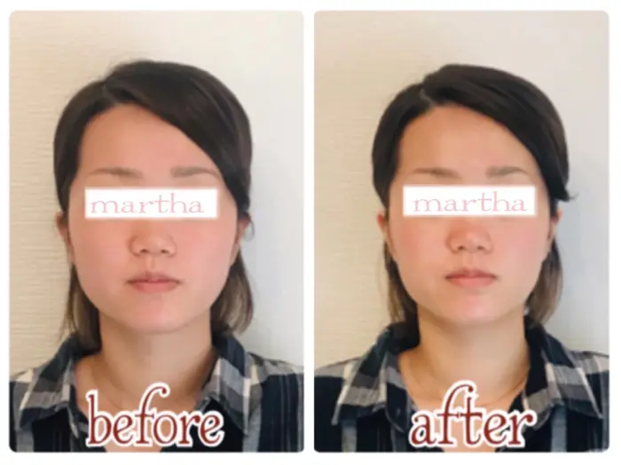 宇治市 代 前撮り前の駆け込みエステでキュッと小顔に 京都の痛くない小顔矯正サ 宇治市の痛くない小顔矯正サロンmartha マーサ 所属 大軒 優子のエステ リラクカタログ ミニモ