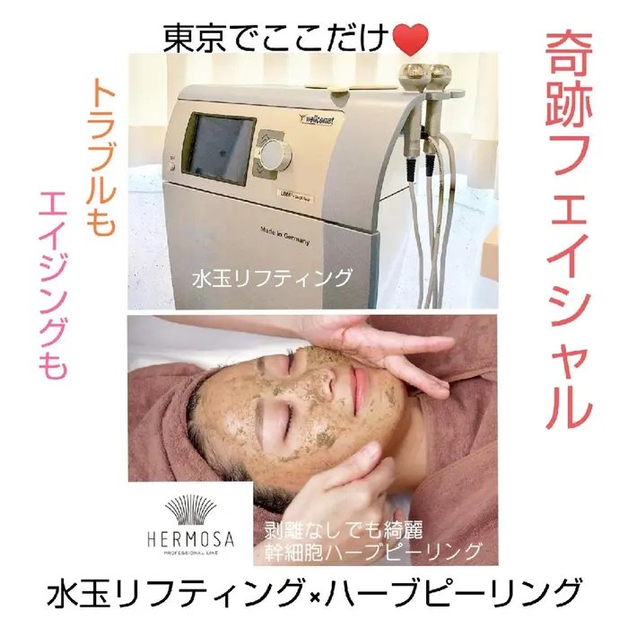 奇跡フェイシャル Salon Vary所属 坂本 ひとみのエステ リラクカタログ ミニモ