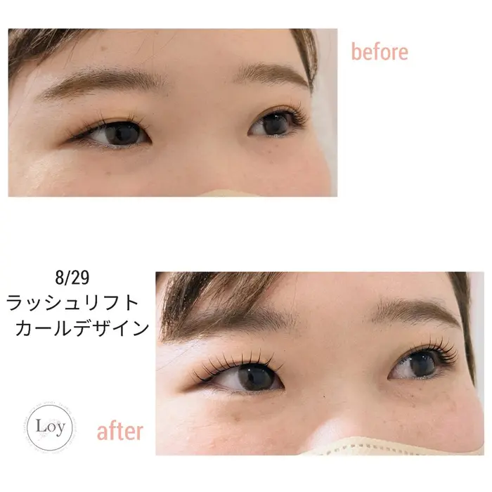 左右差 左右の二重幅が違う 左右で瞼の厚みが違う 両方同じでかけると もっと左右差が気になってし Loy所属 Loy 原田千春 のマツエクデザイン ミニモ