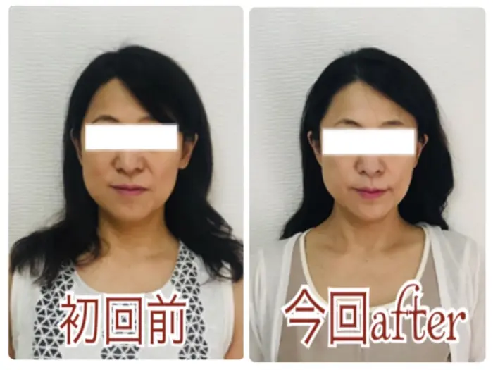 初回と比べるとかなりスッキリ むくみが取れ リフトアップした事で顎のラインもかなり細く 向かって 宇治市の痛くない小顔矯正サロンmartha マーサ 所属 大軒 優子のエステ リラクカタログ ミニモ
