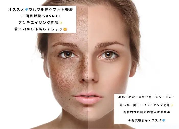 Private Salon Chloe 当サロンは脱毛専門になりますが フォト美顔のメニューもござ Private Salon Chloe クロエ 脱毛 フェイシャル所属 脱毛サロン Chloe クロエ のエステ リラクカタログ ミニモ