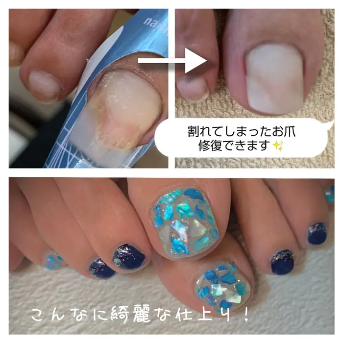 フットネイルの 長さ出し リペア 1本日 440 税込 Nail Eden所属 Nail Edenのネイル デザイン ミニモ