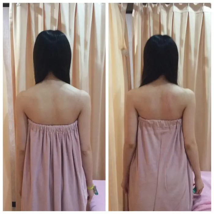 ミラクルバストは背中の無駄肉や二の腕もスッキリ エコロジーエステ Eternal Light所属 浅野かなえ おっぱい先生 のエステ リラクカタログ ミニモ