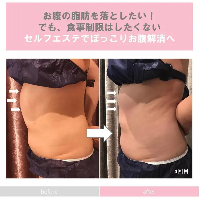 無理なく 効果的にお腹痩せしたい ぽっこりしているお腹にお悩みのお客様の Before セルフエステ Beauty Sharing 表参道 所属 表参道 原宿 セルフエステのエステ リラクカタログ ミニモ