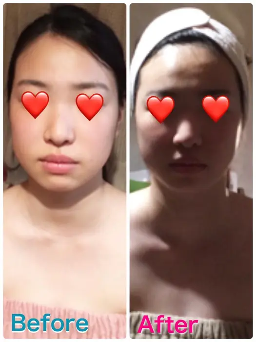 モティーブ痩身ジェルの小顔コースで スッキリしました 小顔 美白 毛穴引き締め たるみを一度に改善 エステティックサロン華々所属 福島 かおりのエステ リラクカタログ ミニモ