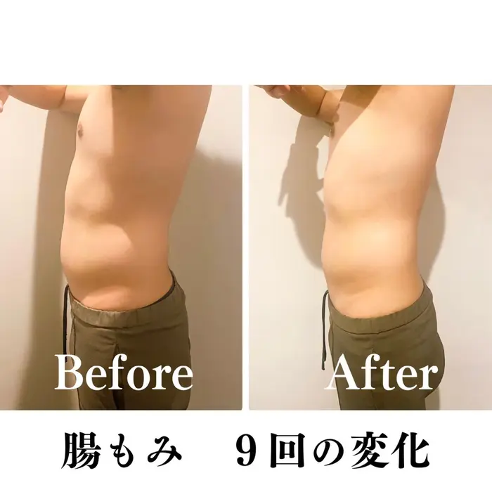 人気no 1腸もみ 美容整体 ブライダルを控えている方 姿勢も体質も綺麗にしたい方 美容整体 腸もみサロンcinq サンク 所属 𝐂𝐢𝐧𝐪 福田歩香のエステ リラクカタログ ミニモ