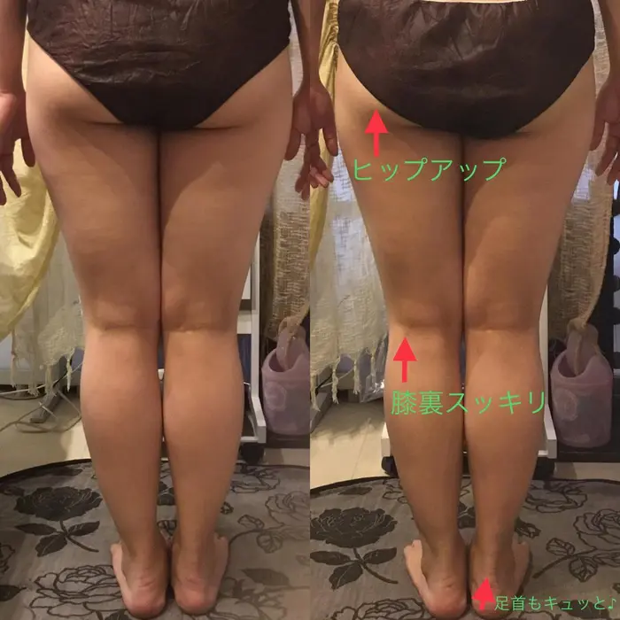 痛みが強いマッサージですが お客様に合わせて調節していきます むくみも取れて 全体的にスッキリします Relaxation Boutique Lico所属 飯田 佳美のエステ リラクカタログ ミニモ