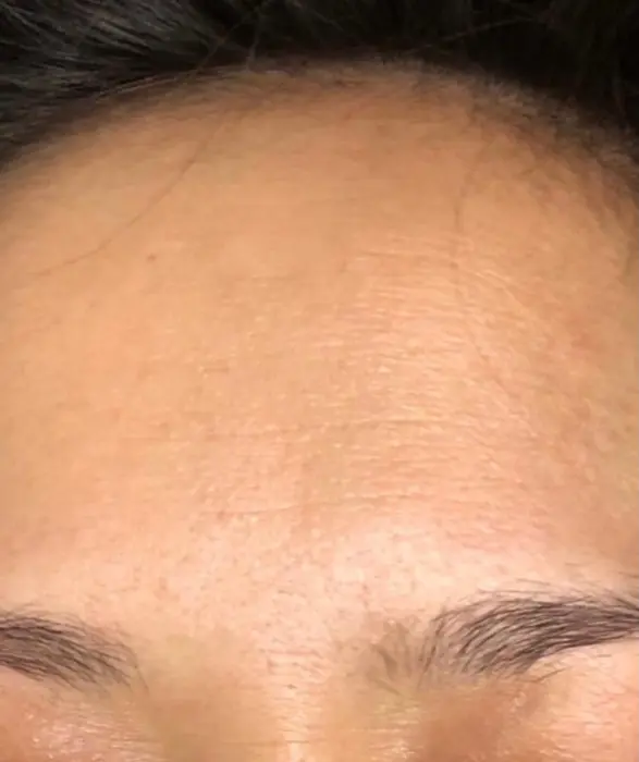 Fcrトリートメントをする前 小ジワにプツプツとできてます R M所属 R Mのネイルデザイン ミニモ