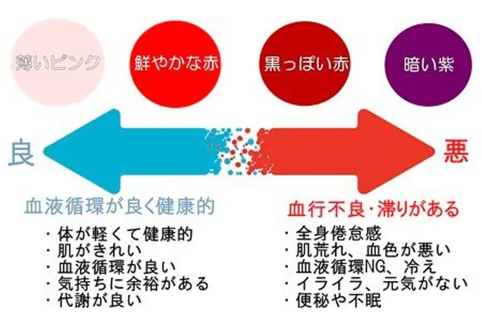吸玉を行った際にできる内出血の色合いです 濃くなればなるほど 瘀血 汚い血 が溜まってる証拠です 成美鍼灸院所属 N Ayanoのエステ リラクカタログ ミニモ