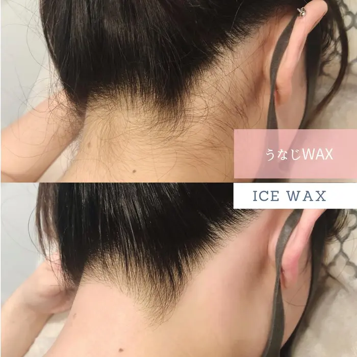 うなじwaxでスッキリした印象に作り上げます ブラジリアンワックスサロンice所属 ブラジリアンワックス サロンiceのエステ リラクカタログ ミニモ