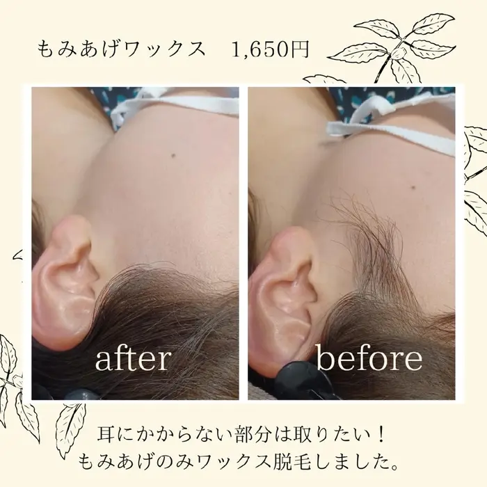 女性 もみあげ Lutella所属 Lutella Waxingのエステ リラクカタログ ミニモ
