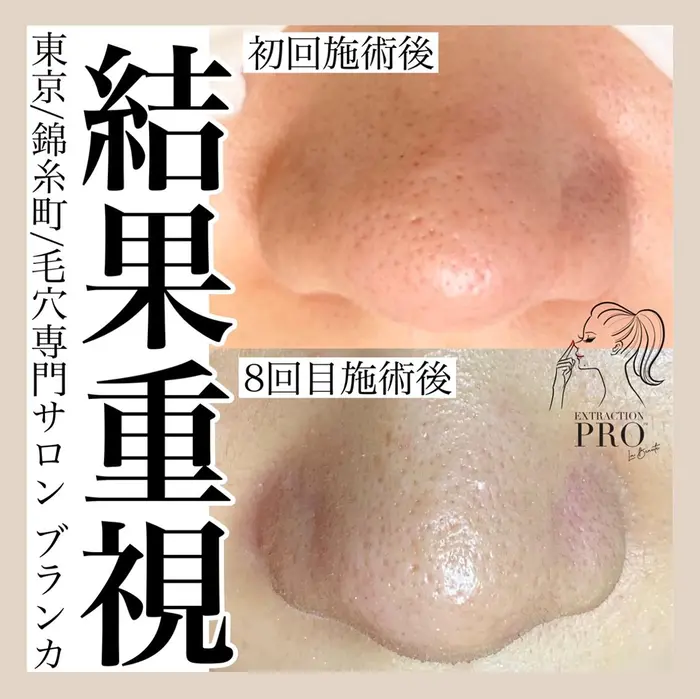 Blancaのエステ リラクサロン エステティシャン セラピスト情報 Blanca 錦糸町 ミニモ