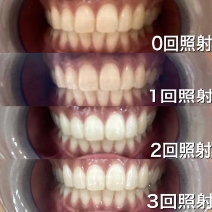 Lipsy三河島のエステ リラクサロン スタッフ情報 リプシ 三河島店 ミニモ