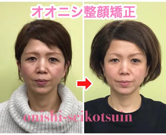 大西整骨院の美容室 美容院 スタッフ情報 大西 広大 ミニモ