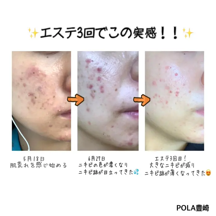 Pola豊崎店所属 Pola豊崎店 安谷屋のメニュー Minimo ミニモ